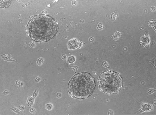 cells (CDCs, 5) 1 2 3