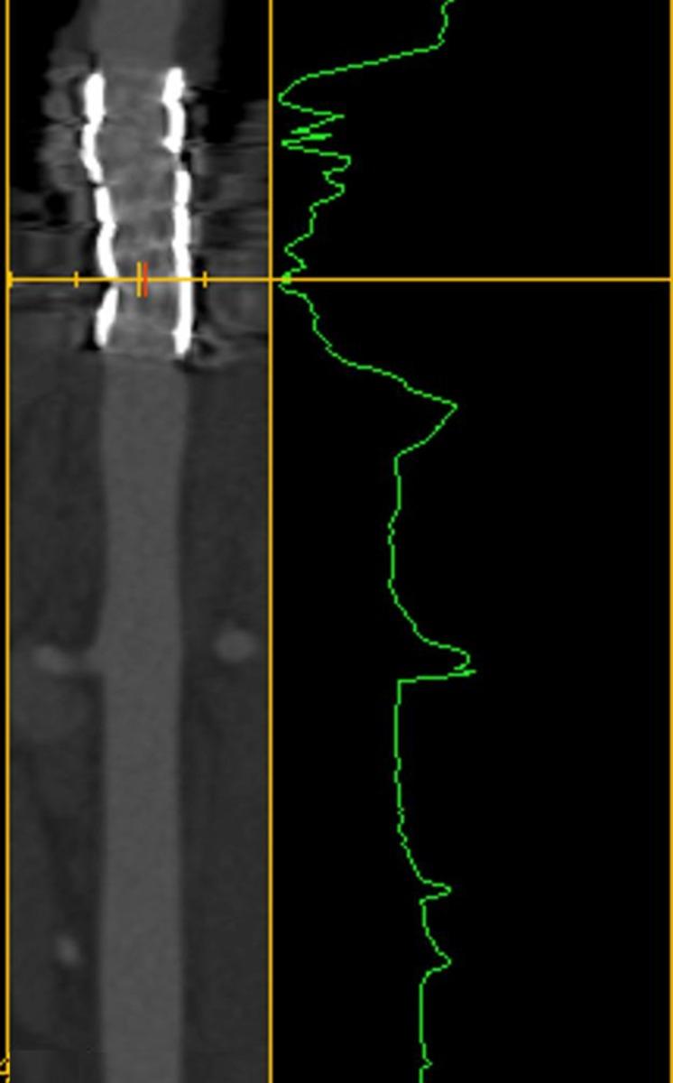 Fig. 10: Image after placement of coated