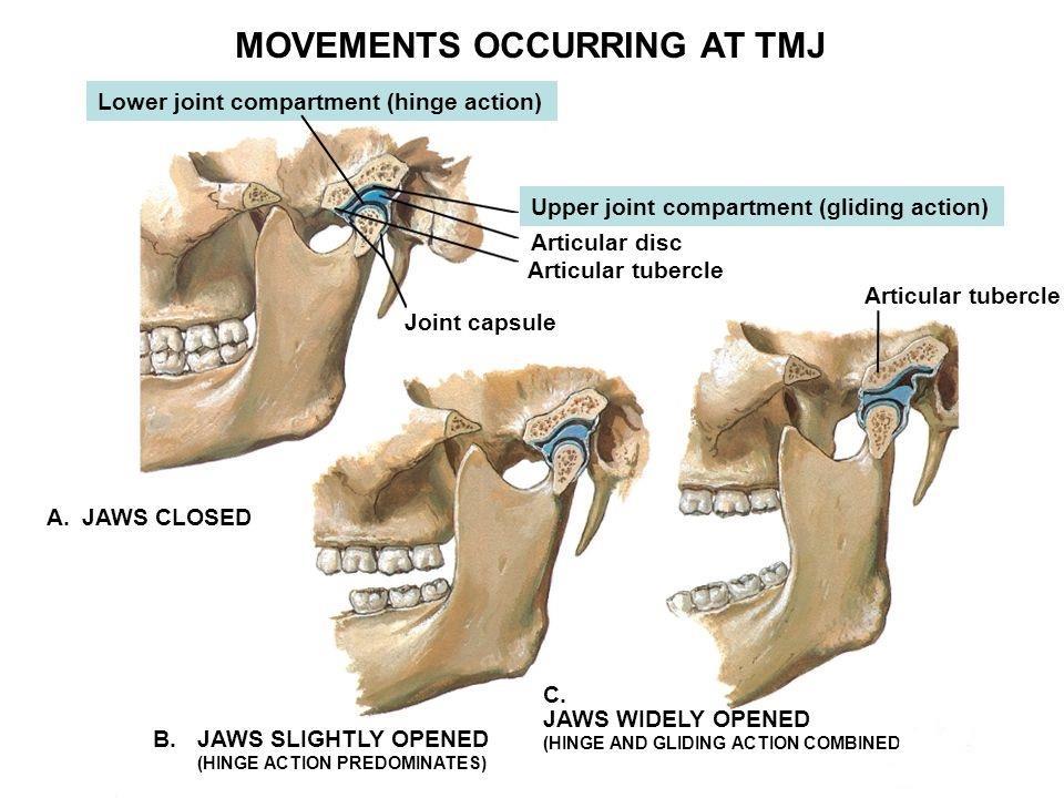 MOVEMENTS OF TMJ The 2 type of movements which can occur in TMJ are; 1.