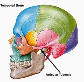 ARTICULAR EMINENCE Is a bony eminence present at the inferior aspect of the zygomatic process of the temporal bone