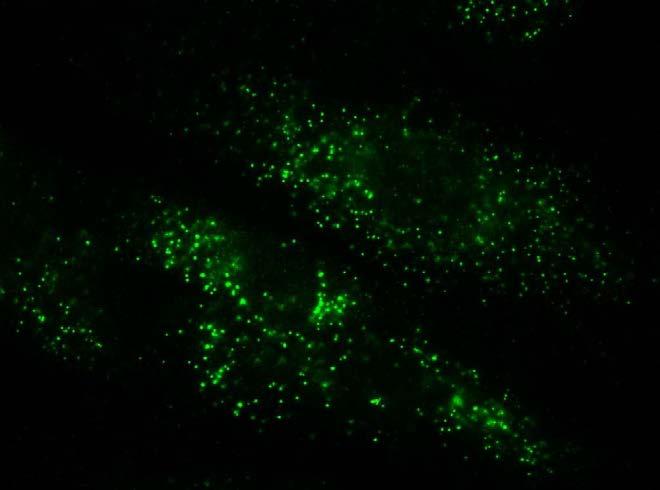 ALDP expression Immunofluorescence: - - - -