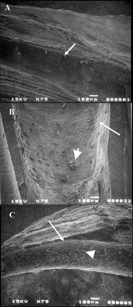 Figure 1. SEM pictures of sectioned roots after Resilon was removed by ProFiles. Arrows indicate the root canal wall and arrow heads indicate the debris after retreatment.