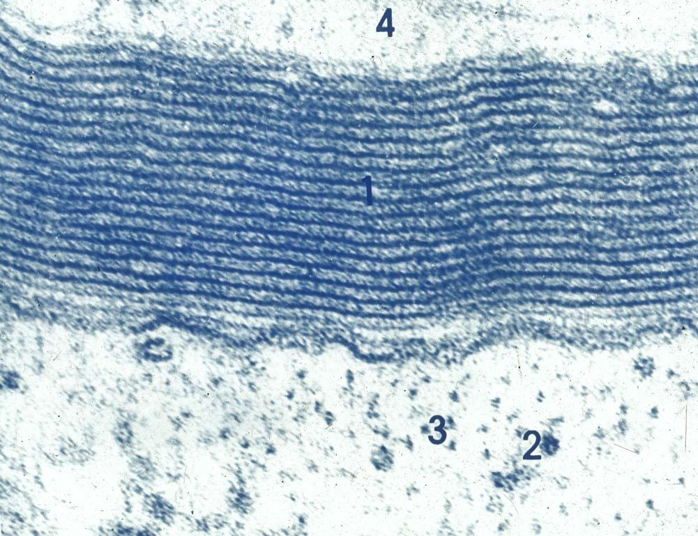 cytoplasma of Schwann cell Myelin sheath axon cytoplasma of Schwann cell Neurofilament microtubule Electron