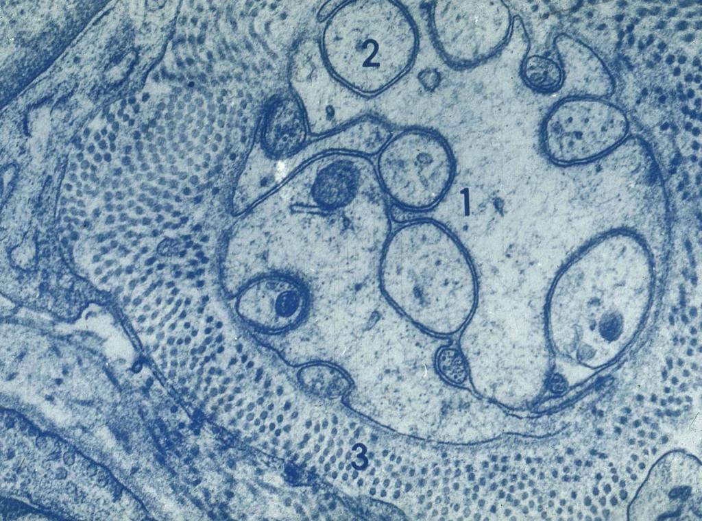 axons Schwann cell Transverse section