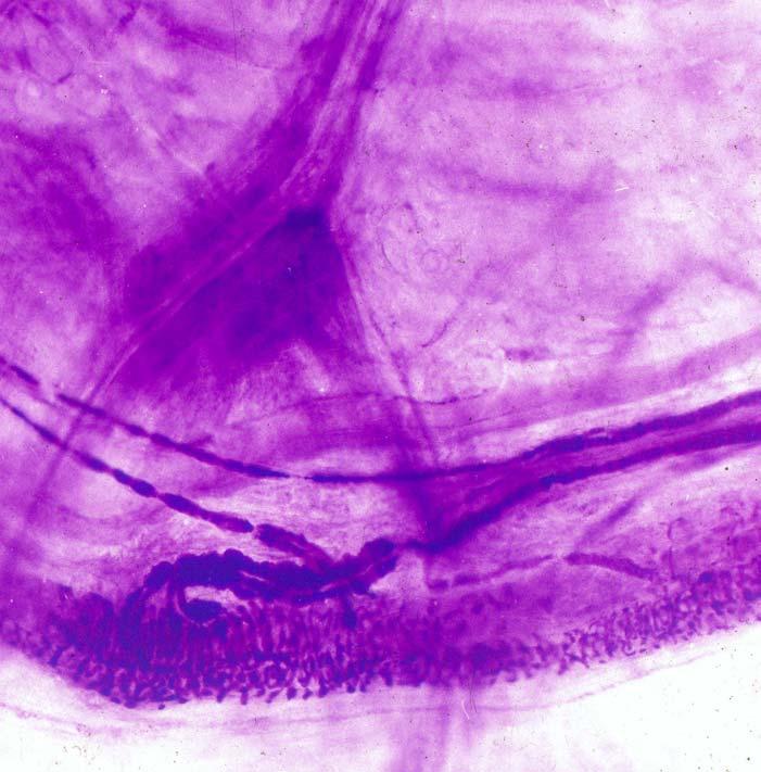 Sensory nerve fiber ending intrafusal muscle