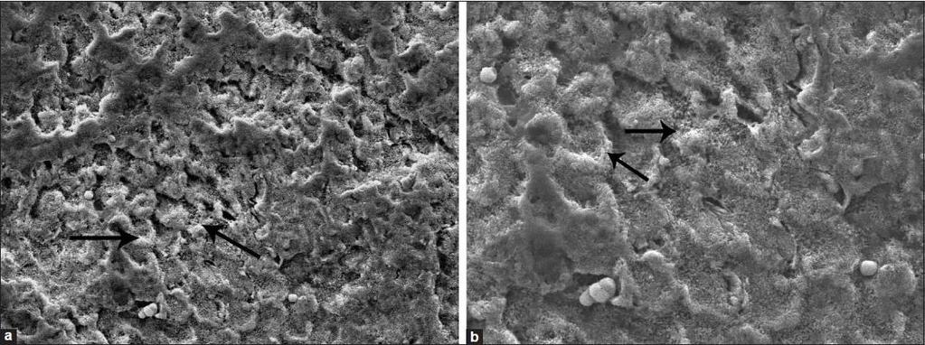 Balk J Stom, Vol 17, 2013 Remineralisation of Enamel Lesions 89 Figure 2. CPP-ACP treated inter-prismatic enamel surface.