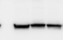 antibody (TPINP: 7kDa, β-actin: kda).
