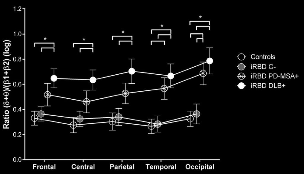 REM EEG slowing predicts conversion to other dementias, too Idiopathic REM behavior disorder increases risk for