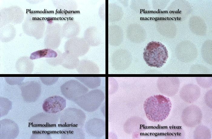 Malaria is a disease caused by a parasite of the genus Plasmodium. More than 150 species of Plasmodium affect different vertebrates, but only four (P. falciparum, P. vivax, P. ovale & P.