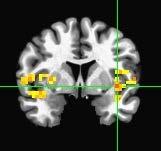 and the superior temporal cortex Brain regions that were activated are involved in: Emotional responses to reward
