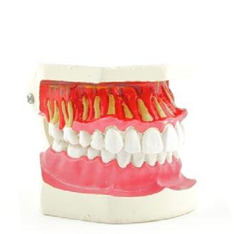 Human Dental Dental Disease Model L6 x H11 x W4,5 cm H130889 8 Human Dental Tooth Development Model 3 to 6 years L7 x H6 x W5 cm H134000 9 Human