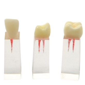 cm 6 Transparent Jaw Model Set of Adult Teeth