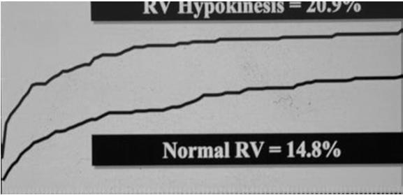 Increased 30-Day Mortality Submassive PE (~25%) Normotensive Right ventricular (RV) dysfunction is