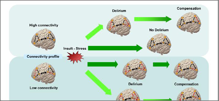 Conceptual Model of Delirium
