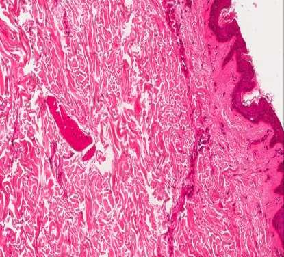 Histological