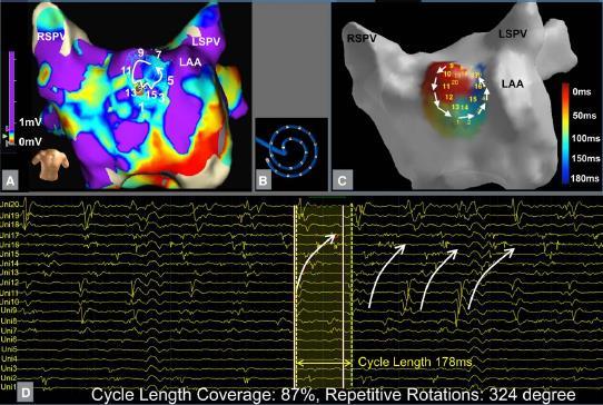 Selective Voltage guided Ablation of