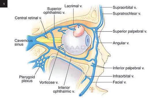 superior ophthalmic vein is a