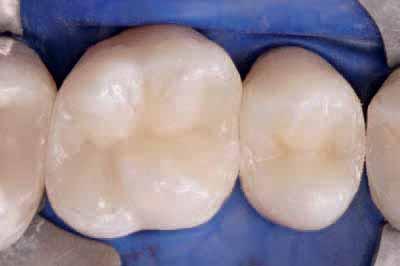 palatal sections of