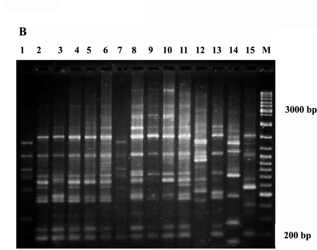 5 unit of Smar Taq DN polymerase (CinnaGen Co., Iran). Reactions were then amplified for an initial denaturation at 94ºC for 45 s followed by 32 cycles of 45 s at 94ºC, 45 s at 55ºC, 2.