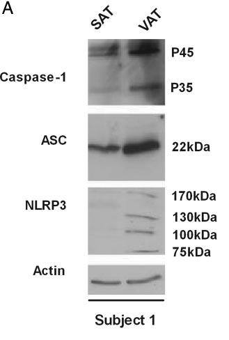 Caspase-1 activity is enhanced in human