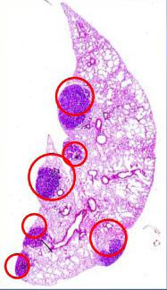 Chemically-Induced Mammary Tumors NS inhibited N-methyl-N-nitrosourea-induced (MNU) mammary tumors B.