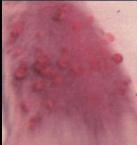 5 Figure 7 Figure 4 Figure 5 Breast tumors were induced in female rats by exposing them to N-methyl-N-nitrosourea (MNU).