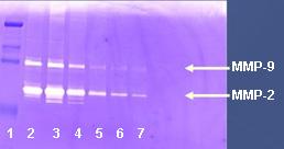 Secretion of MMPs can be measured using Zymography assay which is based on a separation of these proteins by gel electrophoresis and detecting the presence of MMP2 and MMP9 based on their proteolytic