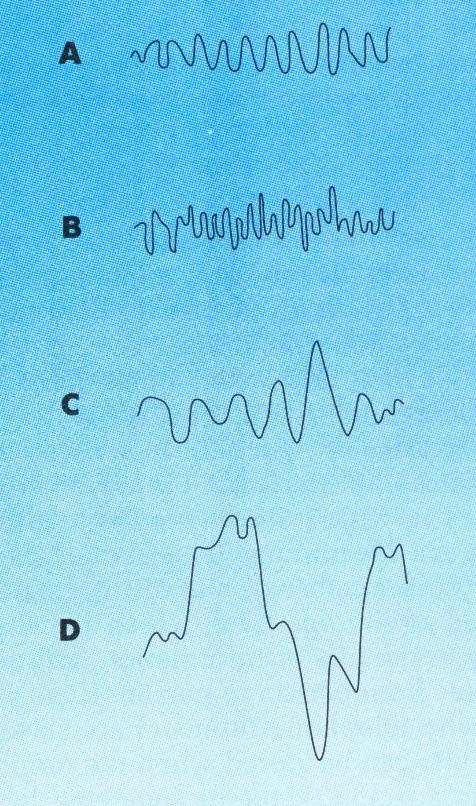 Electroencephalography (EEG) A technique for recording electrical