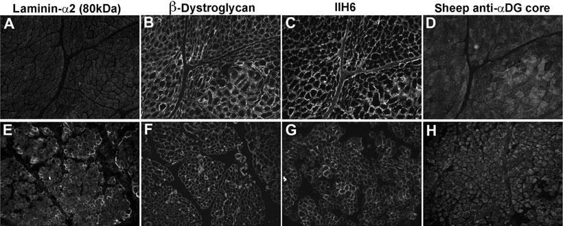 Jimenez-Mallebrera et al a-dystroglycan Glycosylation in Dystroglycanopathies Figure 8. Cases with confirmed primary laminin-a2-deficient congenital muscular dystrophy. A,E.