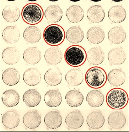 fibroblast -dystroglycan assays complementation assay using on-cell western blot control mock adenovirus infection POMT1 POMT2 POMGnT1 FKTN FKRP POMT1