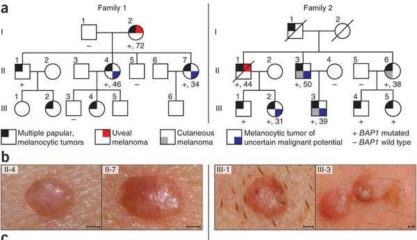 melanoma and atypical melanocytic tumors Wiesner et al.