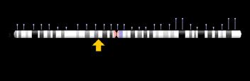 genes E318K mutation leads to higher MITF activity MITF E318K predisposes to melanoma