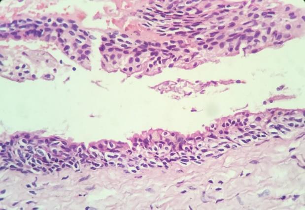 connective tissue were detected. (Hematoxylin and eosin stain (HE), original magnification x100) Figure 3.