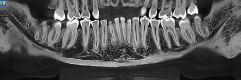 are ideal of teeth or fractures, bone density and depth, and the