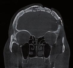 3D images the case of post-operative scans, the presence of any