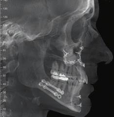 takes the examination of the Temporomandibular Joint to a new