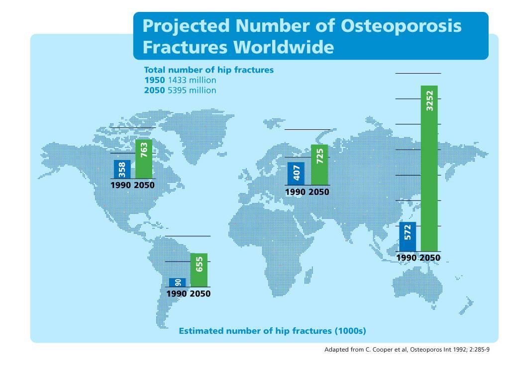 Prevalence of osteoporotic fracture is on