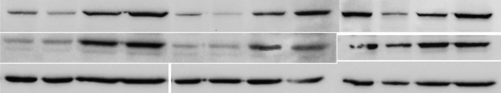 Lozano-Sepulveda SA et al. SAM decreases HCV-RNA expression A 1.2 B 1.2 HCV-RNA level (ΔΔCt) 1.0 0.8 0.6 b 0.4 0.2 b b d d d 0.