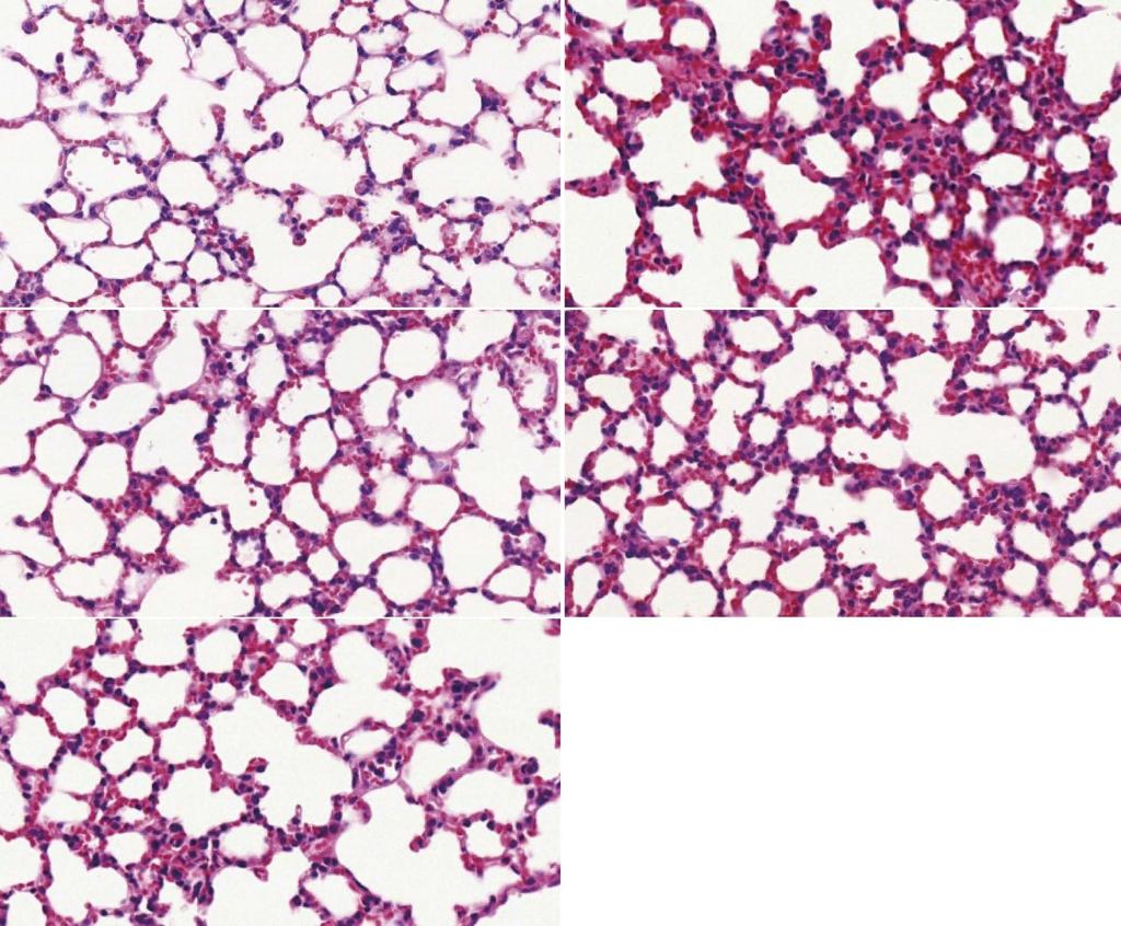 Wang J et al. Signaling in ischemia/reperfusion injury A B C D E Figure 3 Hematoxylin and eosin staining of lungs in all groups (magnification 400).