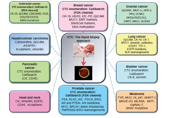 CIRCULANT TUMOR CELLS (CTCs) 1 CTC/ 10 9 blood cells. Cell Search was approved by FDA (detection of epithelial markers).