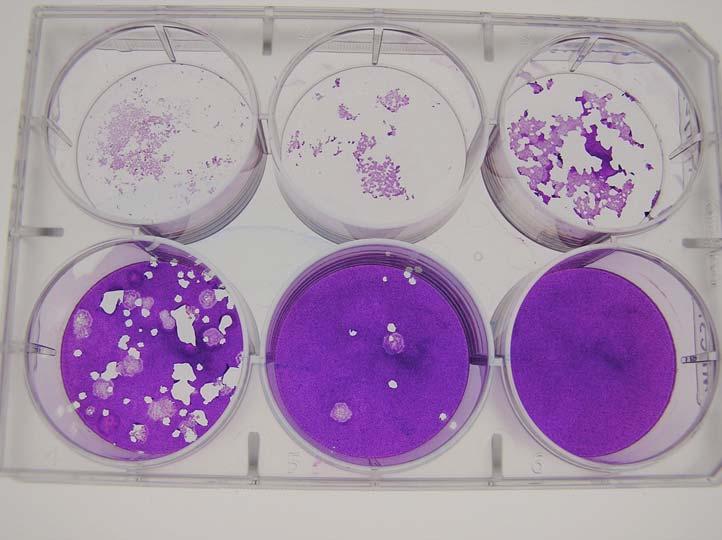 A. Plaque assay from a sample from hypoxic cells.