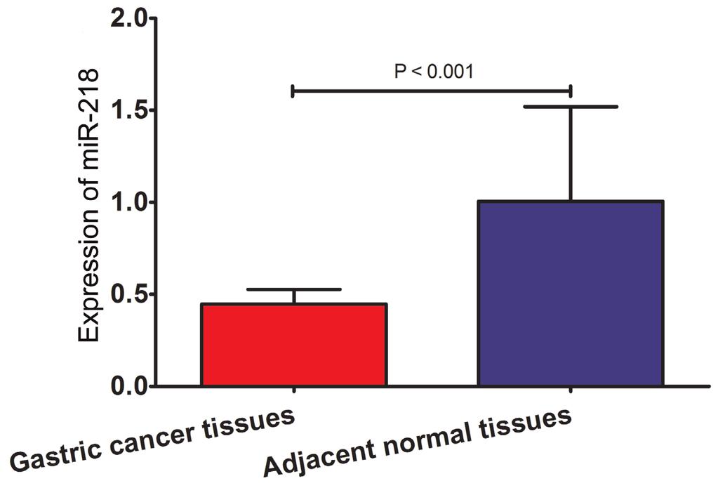 X.X. Wang et al. 4 Figure 1. Relative mir-218 expression in gastric cancer tissues and adjacent normal tissues. Table 1. mir-218 level and clinicopathological features in patients with gastric cancer.