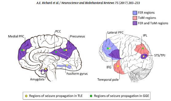 Disorders of Network Function Neural bases of