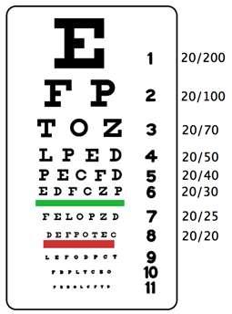 EIGHT DIAGNOSTIC STEPS 1 VISUAL ACUITY Snellen eye chart 2 PATTERN OF REDNESS Subconjunctival hemorrhage Conjunctival hyperemia Ciliary flush or combination of these 3 CONJUNCTIVAL DISCHARGE 4
