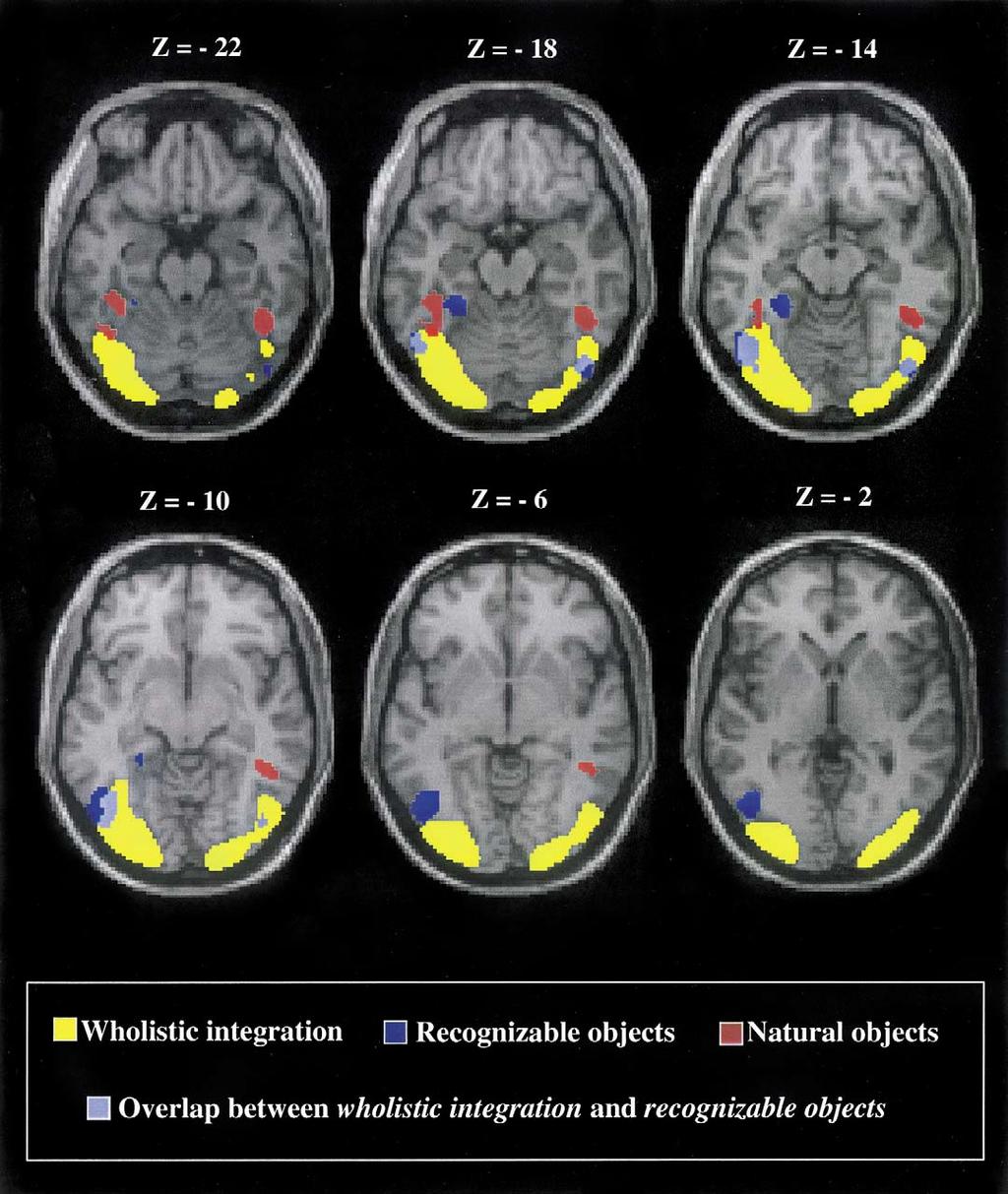 1258 C. Gerlach et al. / Neuropsychologia 40 (2002) 1254 1267 Fig. 2. Six horizontal sections showing the areas associated with: wholistic integration = yellow, recognizable vs.