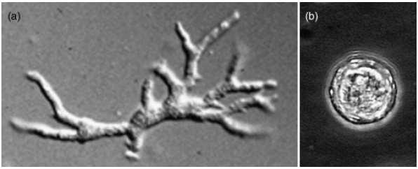 Balamuthia mandrillaris Trophozoite 15-60 µm