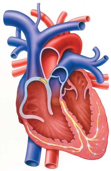 What is Atrial Fibrillation? Atrial Fibrillation is the most common heart rhythm disturbance.