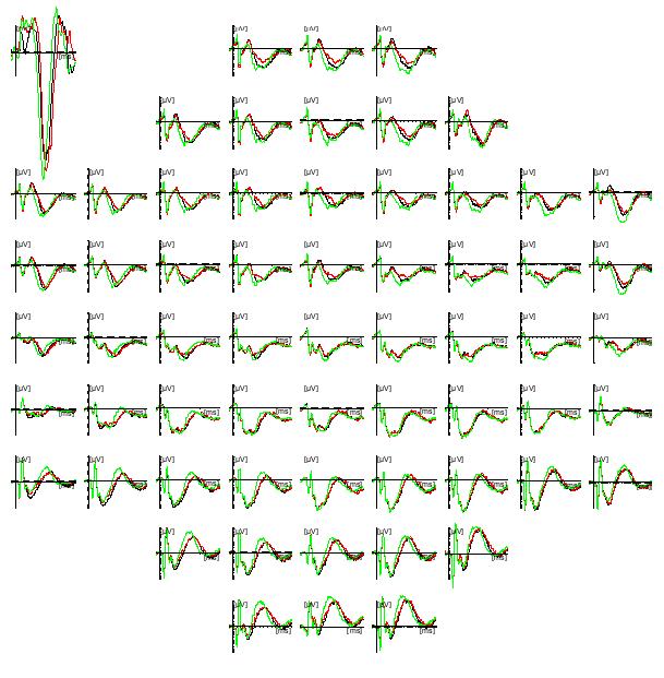 EEG Correlates of NP µv 2 1 