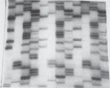 VERTICAL TRANSMISSION OF HBV 596 631 A G C T A G C T A G C T I II III Fig 2 Direct sequencing of HBV S gene nucleotides 596 ~ 631 from father and fetus in case 4.