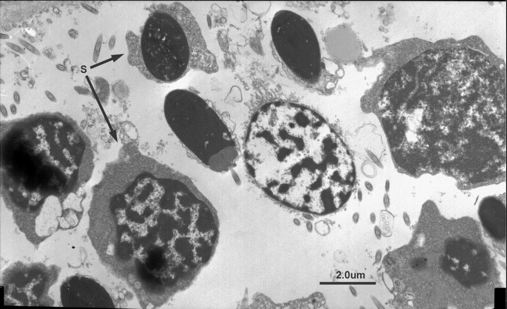 Micron bar = 2.0μm. Figure 3. P. lacustris. Positive staining with uranyl acetate and lead citrate. S, mature spermatid (immature spermatozoan).